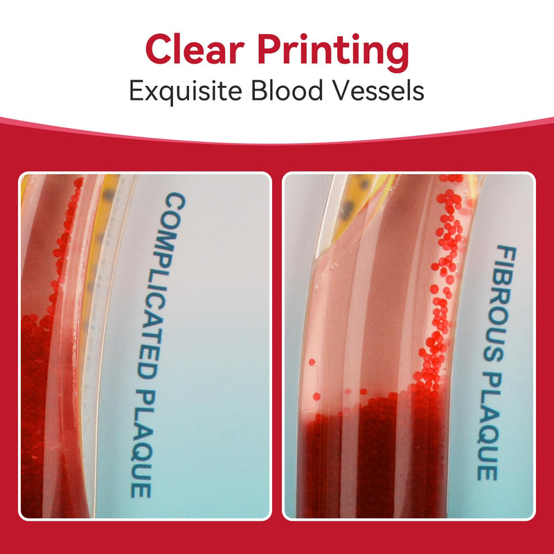 Medarchitect Low-Density Lipoprotein LDL Blood Vessel Model for Medical Patient Doctor Teaching