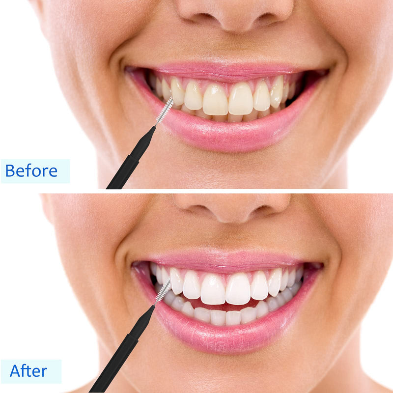 Patelai 100 Pieces Braces Brush for Cleaner Interdental Brush Toothpick Dental Tooth Flossing Head Oral Dental Hygiene Flosser Toothpick Cleaners Tooth Cleaning Tool (Black) Black