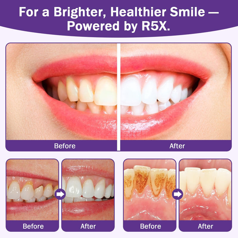Purple Teeth Whitening Powder, Hydroxyapatite R5X Tooth Powder for Coffee, Tea, Smoke Stain Removal, Breath Freshener & Sensitive Dental Care, 2 Pack