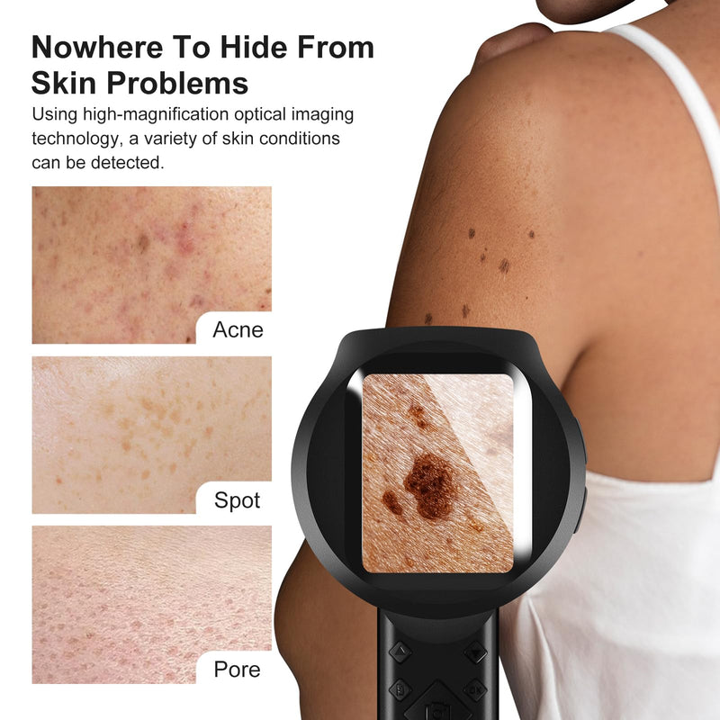 Handheld Dermatoscope, 500X Magnification Skin & Scalp Analyzer for Scalp/Hair Trichomes Facial Skin Dermatoscope, 16MP Camera for Hair Follicle Observation, Digital Microscope with 2.8" Screen