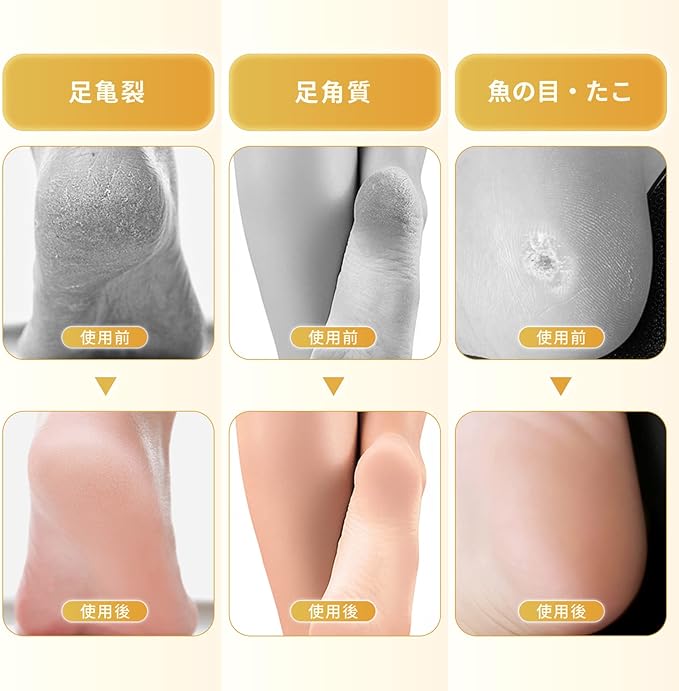 Annhua Natural Pumice Stone, Keratin Care, Volcanic Stone, Foot Care Tool, Washable, Reusable Use, Unisex, Smooth Heels, Skin Care, Heel Sharpening, Foot Massage, Promotes Circulation, Foot Pumice, Bath Stone, Foot Care Set, White - NewNest Australia