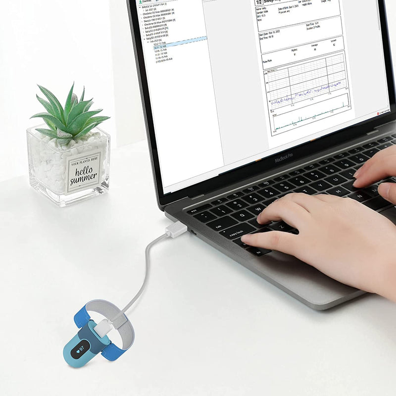 Original D-Type USB Charge Data Cable for Checkme O2 Max, SleepU, VisualOxy, Oxiband Ring Pulse Oximeter, BabyO2, BabyO2 S2