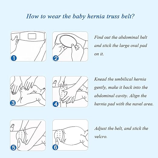 Paskyee Umbilical Hernia Belt Baby Belly Button Band Infant Belly Wrap Hernia Truss Support Adjustable Navel Belly Band Newborn Umbilical Cord (Blue) - NewNest Australia