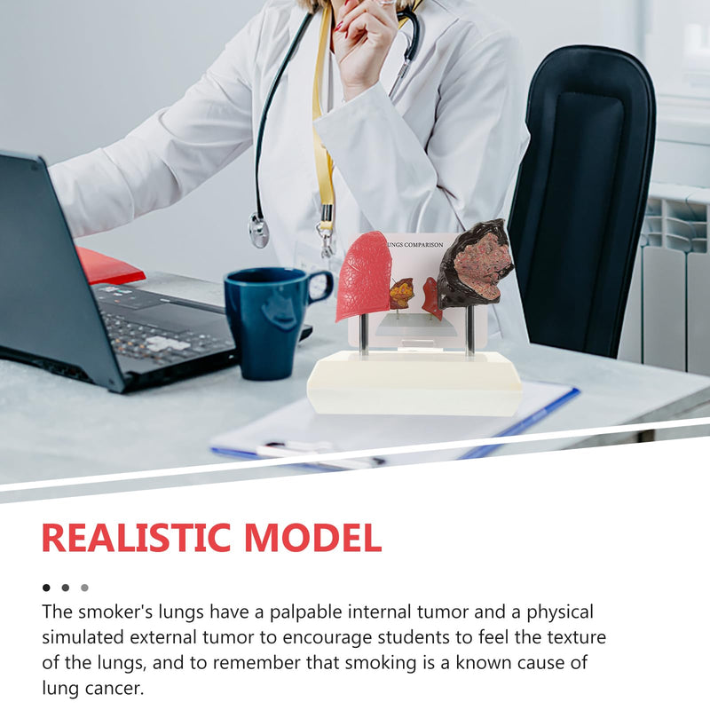 Hemoton Smoking Lung Model and Normal Lung Comparison Pulmonary Anatomy Model for Teaching 7.87X7.08X5.51 Inch Realistic Respiratory Health Education Tool