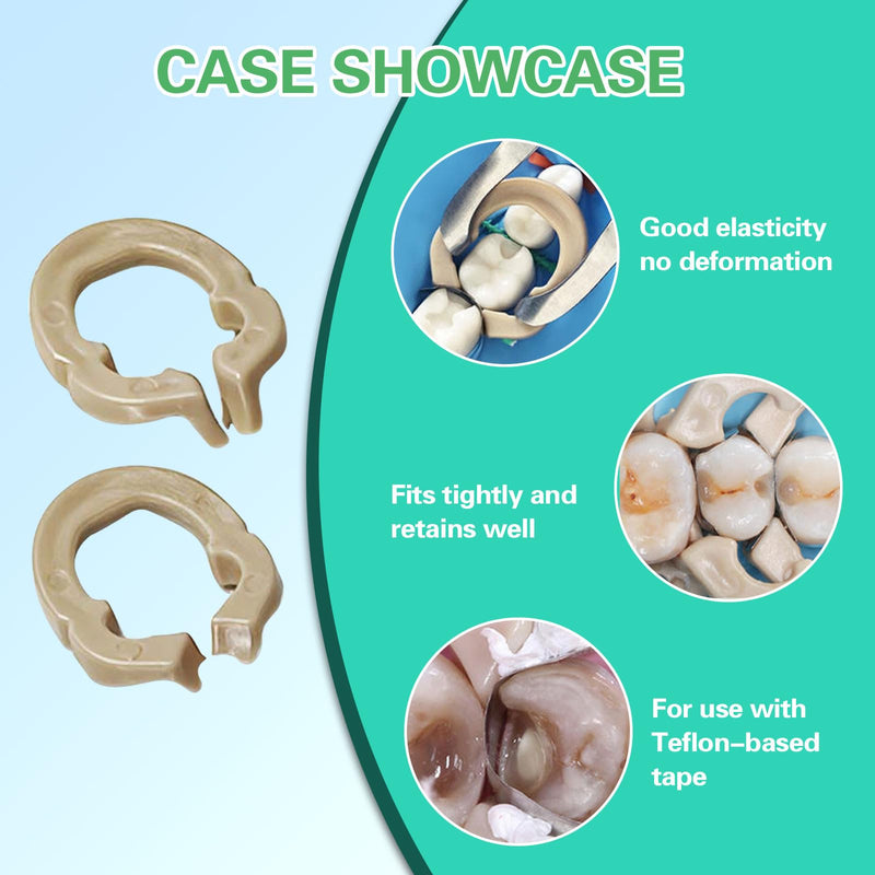 Dental Sectional Matrix System Kit, Dental Sectional Matrix Resin Clip Clamping Ring, M2 Dental Matrix Bands Suitable for Repairing Longer Surface Contacts.