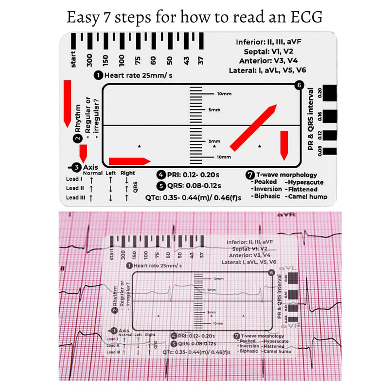 2 Pack ECG 7 Step Ruler for ECG EKG Interpretation - Portable ECG Reading with 7-Step Guide - Tools Gifts for Nurses Men Women