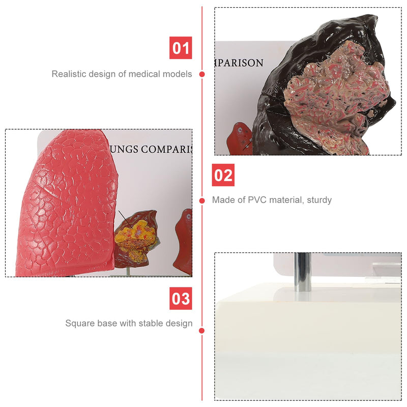 Hemoton Smoking Lung Model and Normal Lung Comparison Pulmonary Anatomy Model for Teaching 7.87X7.08X5.51 Inch Realistic Respiratory Health Education Tool