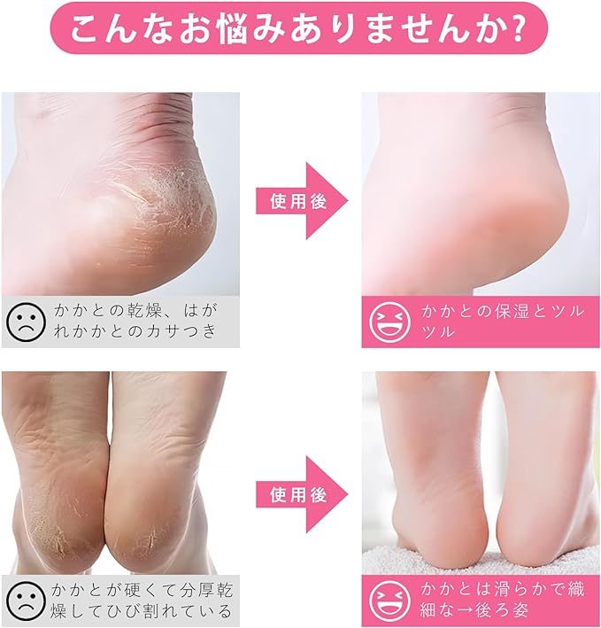 Heel Care Socks, Heel Moisturizing Socks, Set of 4, Heel Care Socks, Quality Care, Anti-Crack, Smooth Heels, Smooth Heels, Moisturizing Protection, Sleeptime, Intensive Moisturizing Socks for Heels, - NewNest Australia
