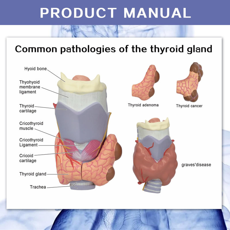 EVOTECH SCIENTIFIC Human Thyroid Pathology Anatomical Model - 4 Parts Life Size Medical Study Education Tool W/Stand and Manual for Demonstrating Goiter, Thyroid Cancer, and Graves’ Disease