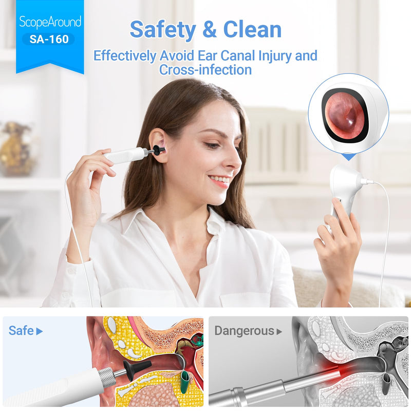 ScopeAround Digital Otoscope with IPS Screen, 720p HD Smart Visual Ear Camera, Ear Scope Otoscope Camera with 6 LED Lights, Ear Wax Removal Tool Camera, Plug & Play