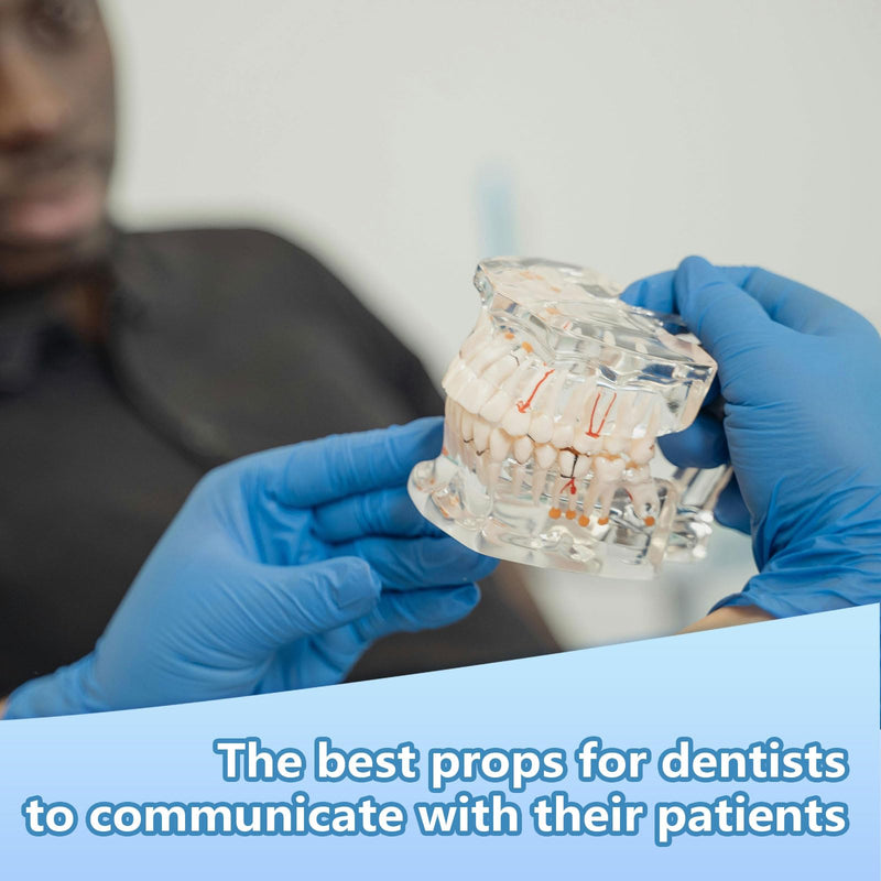 Transparent Disease Teeth Model with Dental Implant Bridge, Dental Teach Crown Bridge Removable Model, Tooth Model for Patient and Dental Student Education. (Red) Red