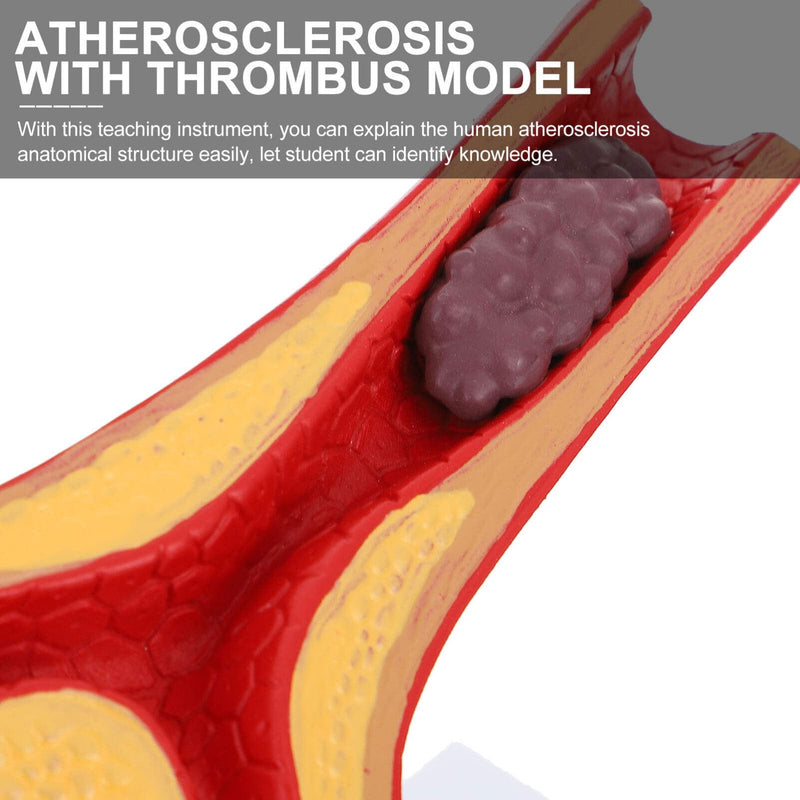 Model Cardiovascular Model Blood Vessel Anatomy with Plaque for Education Teaching Anatomy Display 7.08 X 6.29 X 5.11 in
