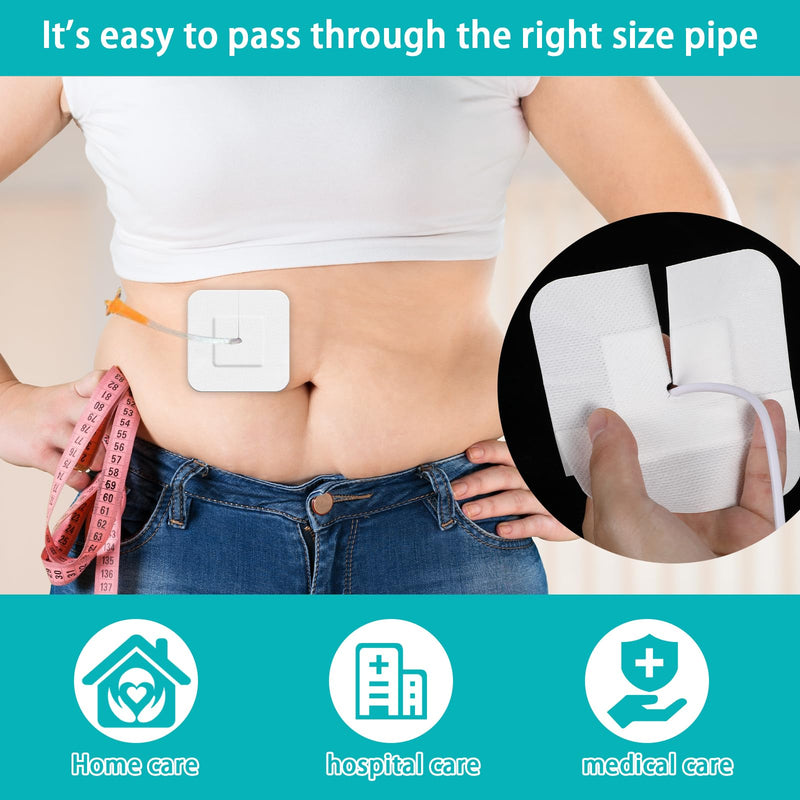 15 Pcs Split Drain Feeding Tube Adhesive Bandages, Peg G J Supra-Pubic Incision Bordered Guaze Pad with 10 Alcohol Cotton Pads, Sterile Drain Patch Supplies Island Dressing(5.9×5.51inch)