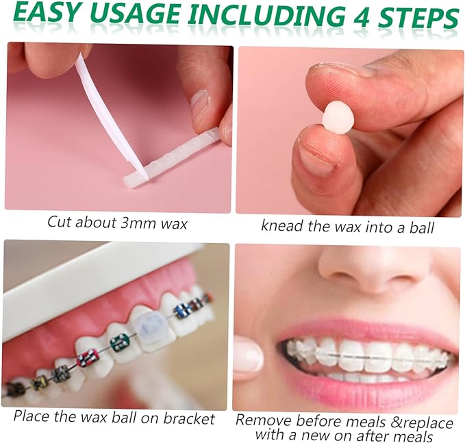 FOMIYES 10 Pcs Dental Wax Utility Wax Strip Brace Wax Oral Care Wax Anti-Brace Wax Anti-Brace Wax Chemicals 10pcs Braces Glue - NewNest Australia