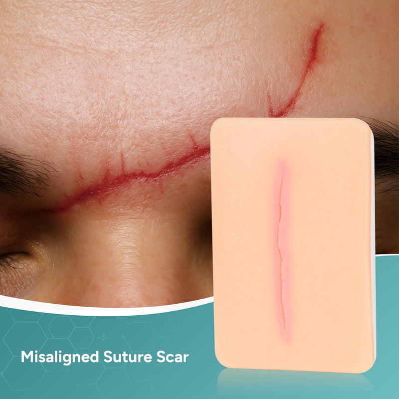 Wound Packing Trainer, Atrophic Scar Model for Medical Education, Wound Care Demonstrations Tool, 3PCS