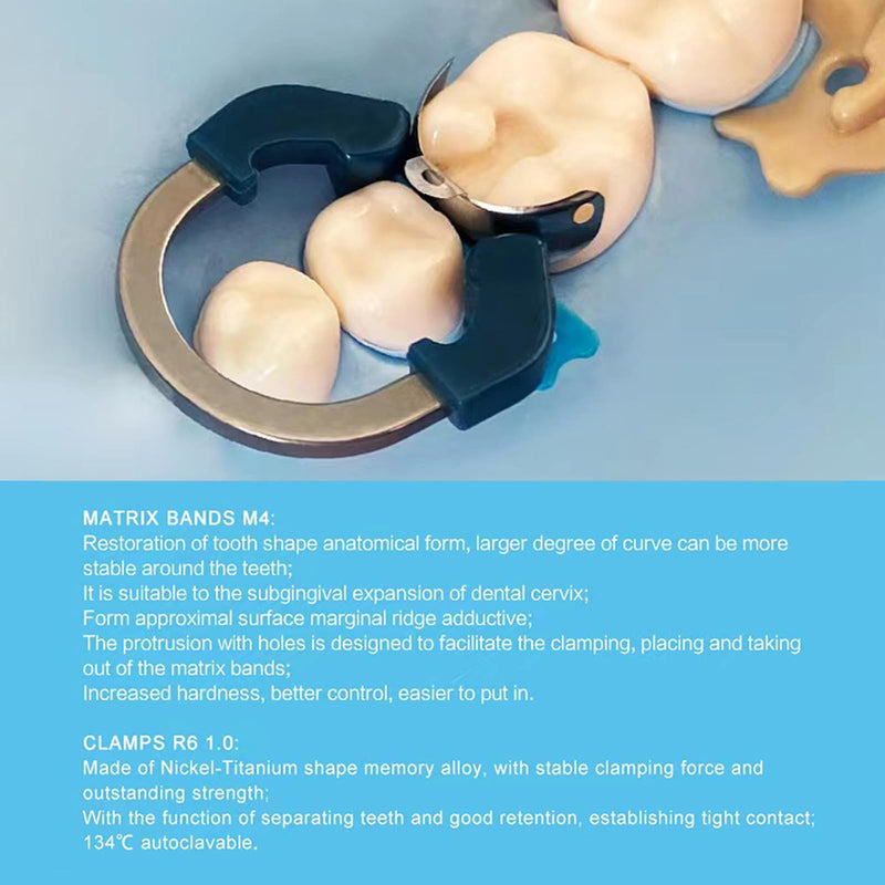 Dental Sectional Matrix Ring Clamp Spring Clip, Autoclavable Nickel Titanium Orthodontic Clamp Rings, Contoured Matrices System for Pre and Post Molars. (R6 QIANLV) R6 QIANLV