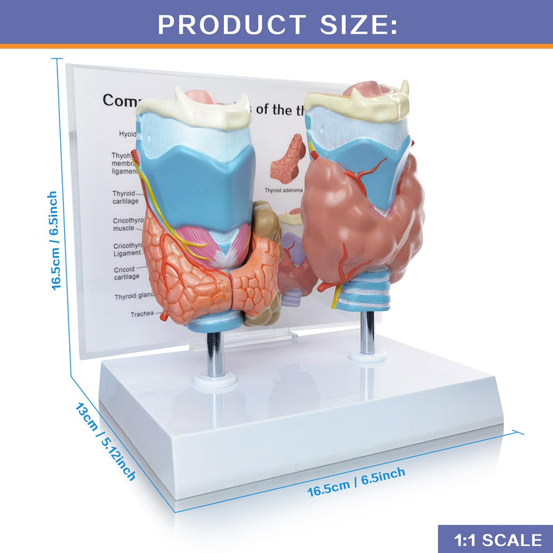 EVOTECH SCIENTIFIC Human Thyroid Pathology Anatomical Model - 4 Parts Life Size Medical Study Education Tool W/Stand and Manual for Demonstrating Goiter, Thyroid Cancer, and Graves’ Disease