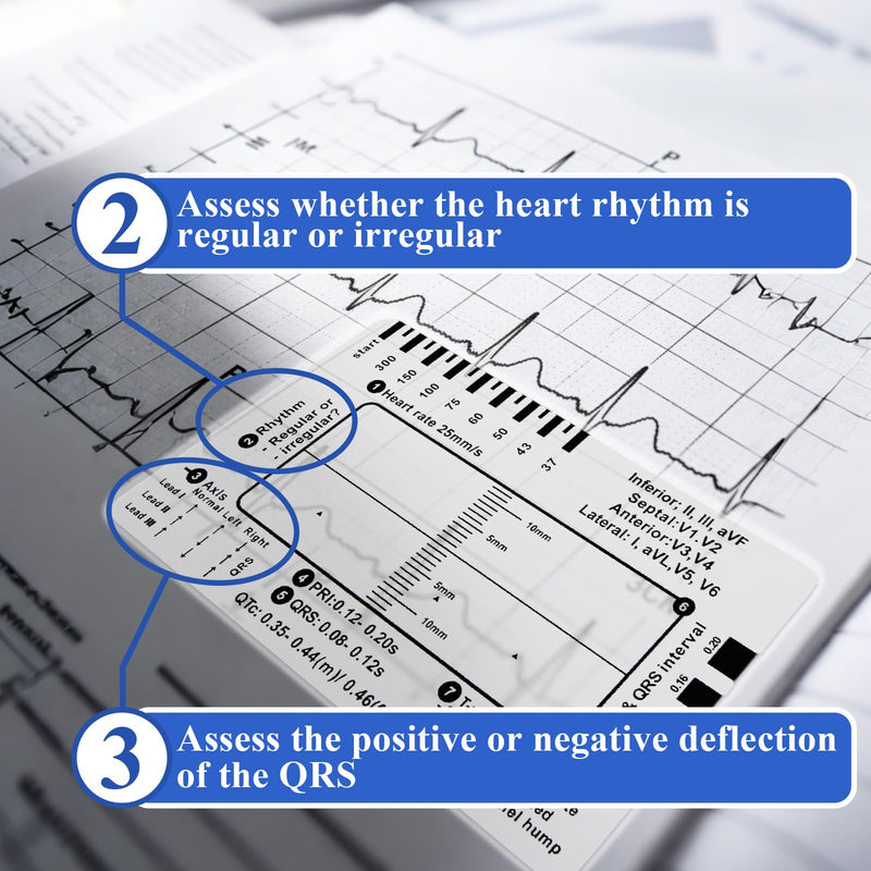 20 Pcs ECG 7 Step Ruler, Transparent EKG Calipers Ruler for ECG/EKG Interpretation, Plastic EKG Card, Portable ECG/EKG Rhythm Pocket Card Measuring Tool, Follows 7 Step Plan