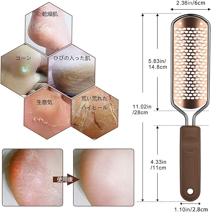 ASXMYAQ Foot File Exfoliating Remover Foot Scraper Pedicure Tool Stainless Steel Foot Slap Heel Exfoliating Exfoliating Exfoliating Foot File Exfoliating Remover for Sharpening, Travel, Wet and Dry Feet - NewNest Australia