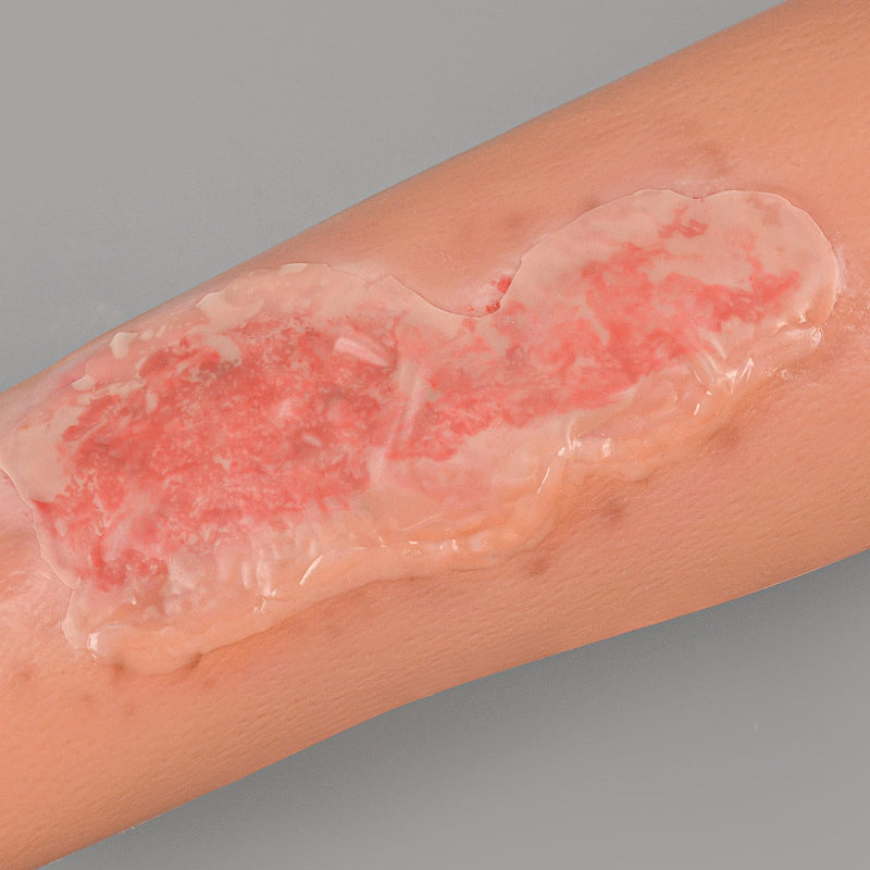 Abrasion Wound Care Training Sleeve, Wound Packing Trainer for Medical Education Abrasion Wound