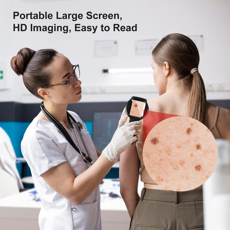 Handheld Dermatoscope, 500X Magnification Skin & Scalp Analyzer for Scalp/Hair Trichomes Facial Skin Dermatoscope, 16MP Camera for Hair Follicle Observation, Digital Microscope with 2.8" Screen