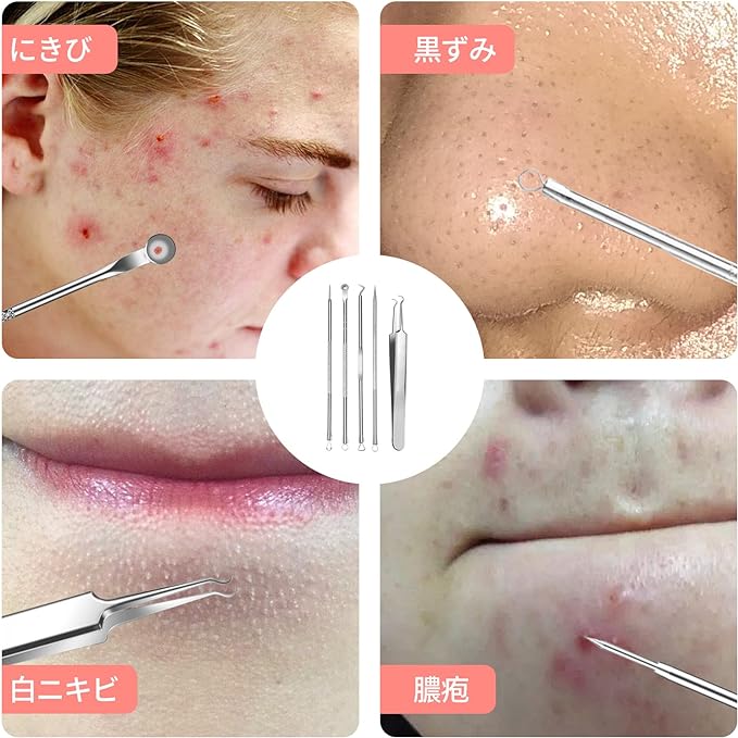 nalaina Square Stopper Remover, Square Plug, Tweezers (Set of 5) Acne Needle Set, Acne Pusher, Square Plug Pusher, Pore Care Kit, Strawberry Nose, Comedo Pusher, Acne Remover, Blackhead Removal, Storage Case, Stainless Steel, Portable, For Men and Women - NewNest Australia
