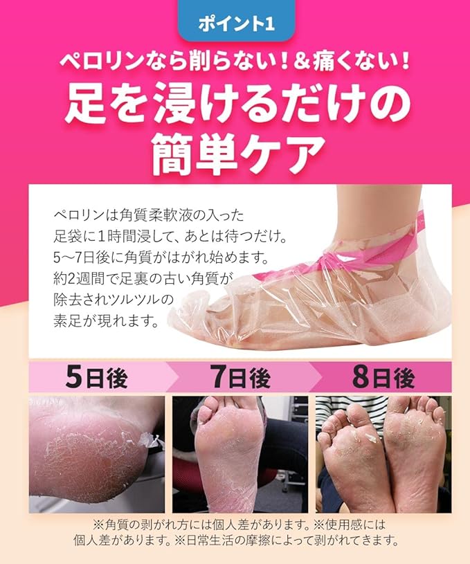 Foot Peeling Pack Perorin (Lavender 1x1) Exfoliating Heel Care Foot Peeling Pack Toes Foot Skin Pack Soft Heel Exfoliating Foot Exfoliating Finger Exfoliating Care Foot Pack Exfoliating - NewNest Australia