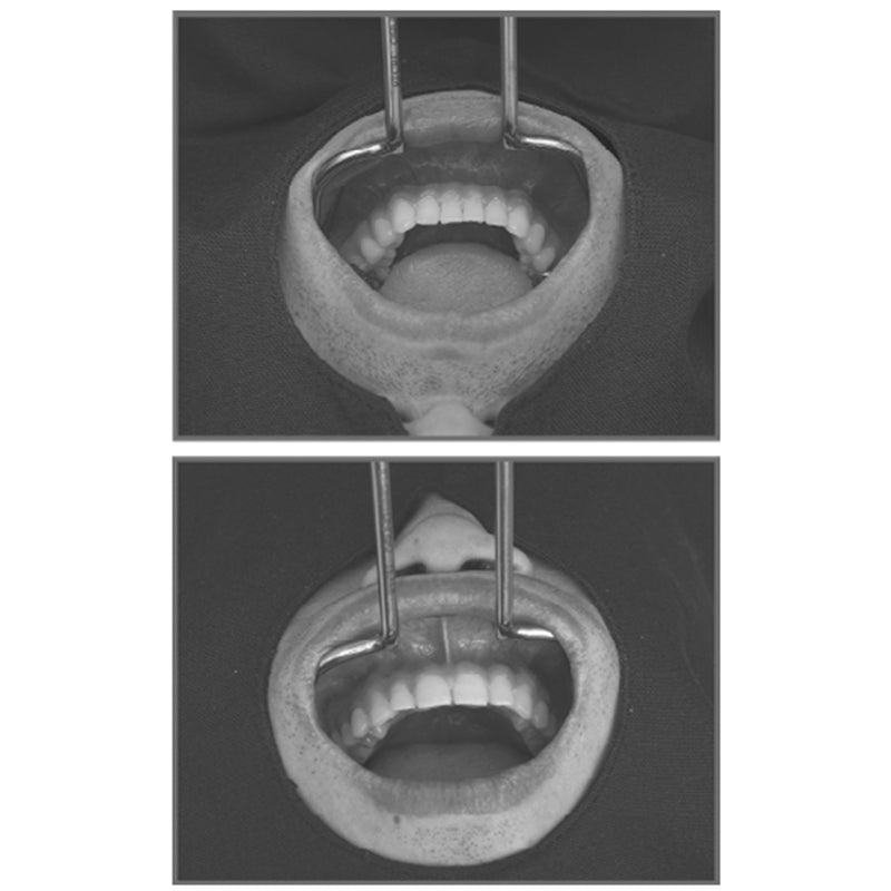Osung Dental Vestibulum Lip Retractor - RTCRL
