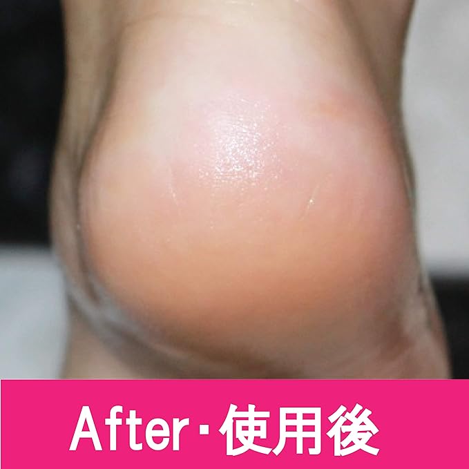 PERFECT NAILS Foot File, Foot Care, File, Waterproof, Exfoliating, Exfoliating, Heel Bath, (Red) - NewNest Australia