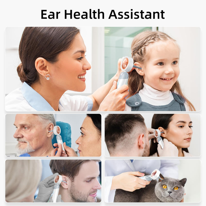 Qimic Otoscope Ear Camera with 1.38'' Screen, 1080P Ear Scope with 4 LEDs, 12 Silicone Specula Tips, Support Photo and Video, PC View, Ideal Pocket Otoscope for Adults, Kids and Pets white