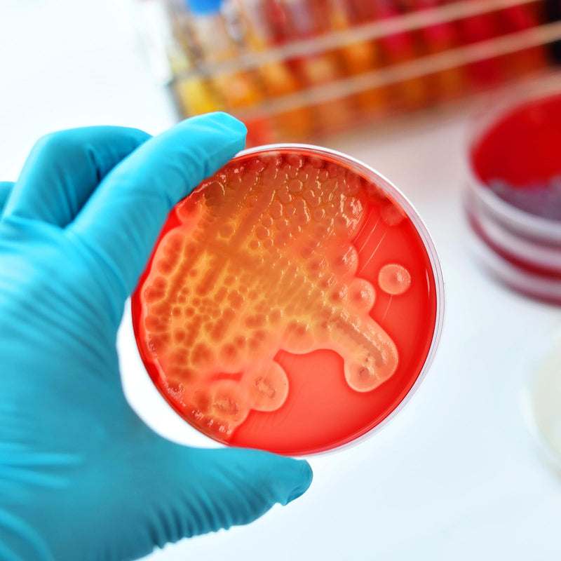 DOITOOL 20 Pcs Prepoured Agar Plates Agar Petri Dishes for Laboratory Science Experiments School Fair Projects