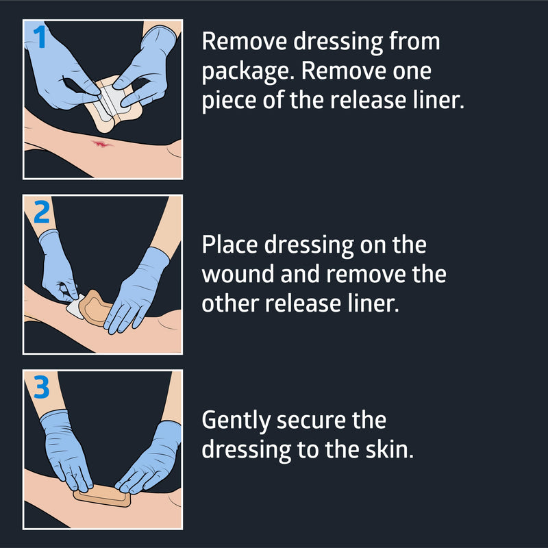 Medline Optifoam Gentle EX Silicone Adhesive Foam Dressing, 4” x 4” Dressing with 2.5” x 2.5", Protects Sensitive Skin, Waterproof, Covers and Protects Wounds, Pack of 3