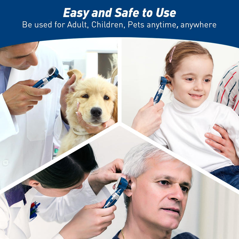 Scian Otoscope - Ear Scope with Light, Fiber Optic Otoscopes with Hard Plastic Case, Pocket Diagnostic Ear Infection Detector for Kids Adults Home Use (Blue) Blue
