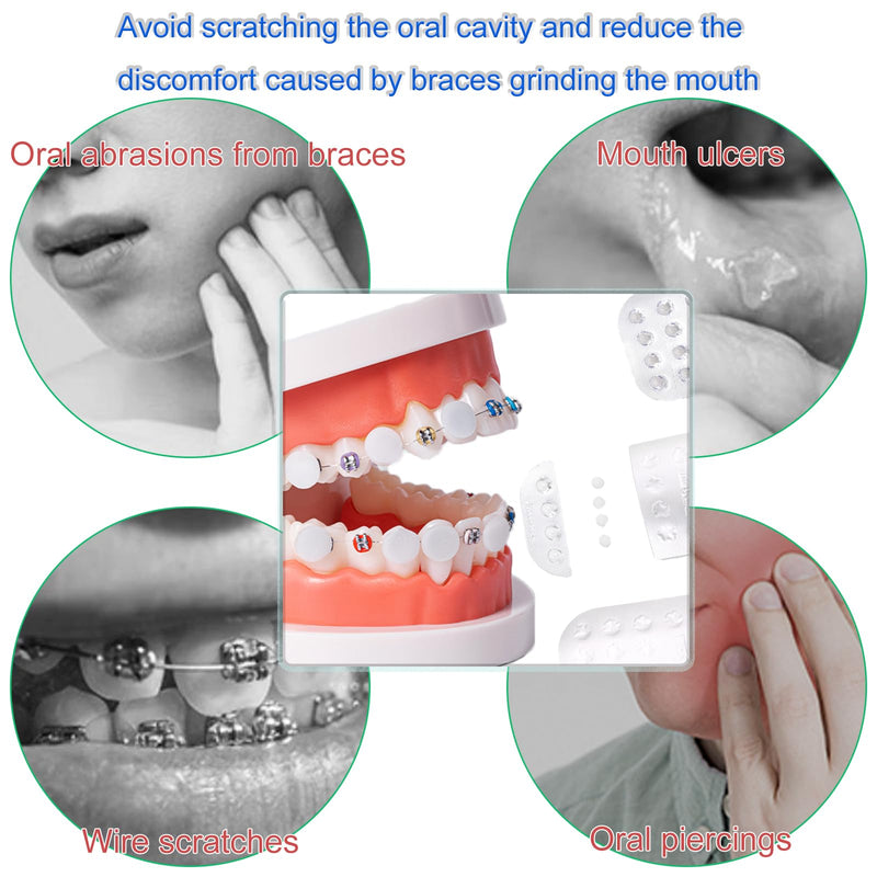 SNAWOP Orthodontic Wax Dots for Braces 66PCS Dental Wax Portable Hygiene Individual Packing