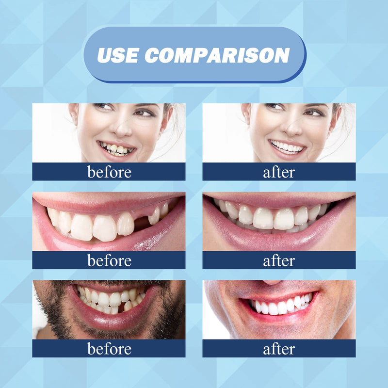 56 Pieces False Teeth, 2 Sets Whole Teeth Synthetic Polymer Denture Teeth, 23 Shade A3 Upper + Lower Dental Materials for Replacement, DIY, or Halloween