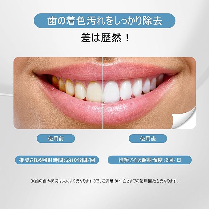 BESTEK Teeth Whitening LED Light Teeth Whitening Mouthpiece: Teeth Care Self Whitening General Medical Device Body Only (Gel Sold Separately) (Vertical Type) - NewNest Australia
