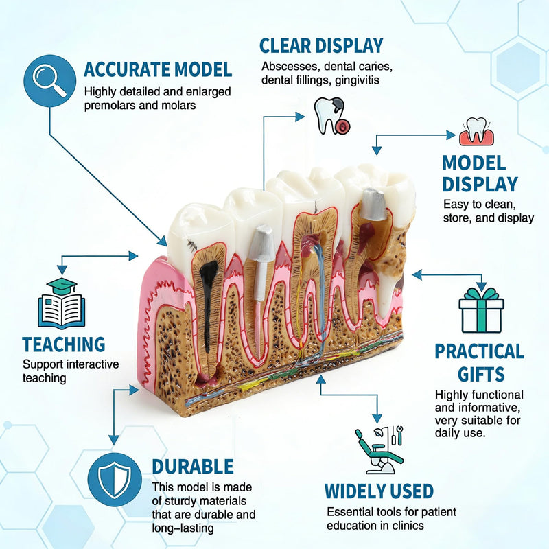 Dental Caries Tooth Anatomy Model Tooth Pathology Models | Caries Evolution Model, Comprehensive Structure Teaching, Oral Study