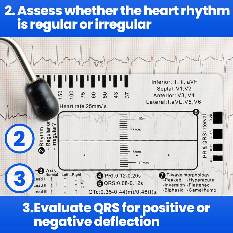 3pcs ECG 7 Step Ruler, Transparent EKG Calipers Ruler, Electrocardiogram Card Portable Plastic Measuring Tool for EKG Interpretation