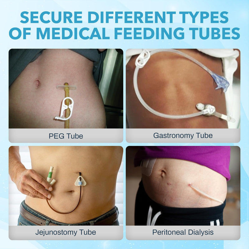 JJ CARE Feeding Tube Belt (Large/Extra Large), Breathable PEG Tube Belt, Nylon Fabric Gtube Belt Compatible with PEG Tubes and Gastrostomy Tubes, Adjustable and Washable G Tube Holder Large to Extra Large (36 to 49 Inch) - NewNest Australia