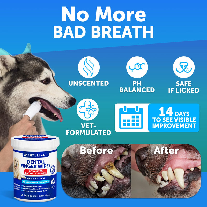 Dog Teeth Cleaning Wipes - 50 Dog Dental Care Finger Wipes - Finger Toothbrush for Removing Plaque, Tartar Buildup, Bad Breath - Oral Freshness, Healthy Teeth & Gum Support with Coconut Oil, Unscented 50 count