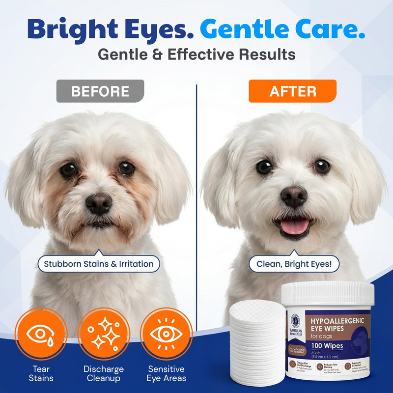 AKC Pet Eye Wipes for Dogs & Cats – Tear Stain Remover & Eye Discharge Cleaner – Hypoallergenic Grooming Wipes, 100 Count (Coconut Scent) Coconut Scent