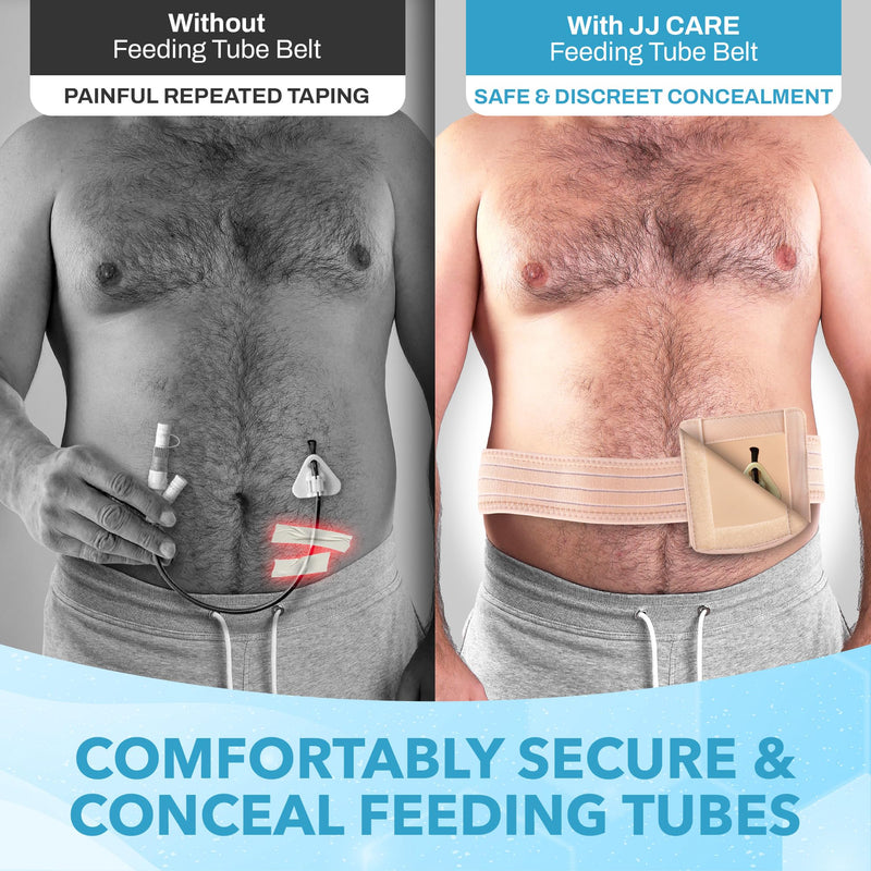 JJ CARE Feeding Tube Belt (Large/Extra Large), Breathable PEG Tube Belt, Nylon Fabric Gtube Belt Compatible with PEG Tubes and Gastrostomy Tubes, Adjustable and Washable G Tube Holder Large to Extra Large (36 to 49 Inch) - NewNest Australia