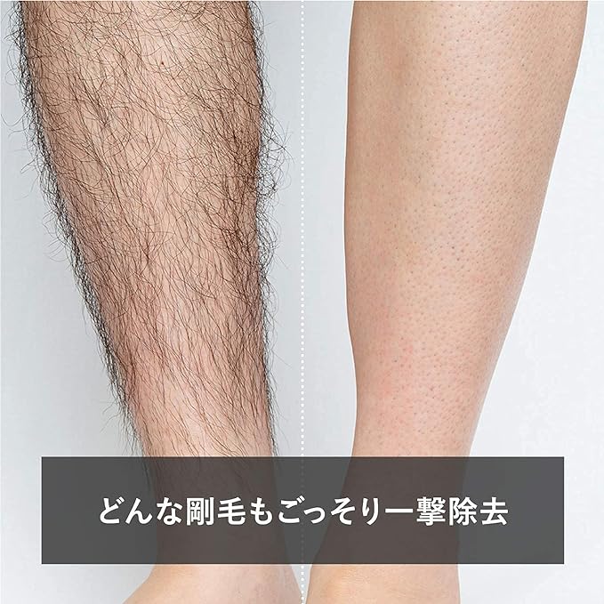 The Future Hair Removal Cream for Men, Hair Removal Cream, Razor, No Need (Men's Hair Removal Cream) 7.1 oz (200 g) - NewNest Australia