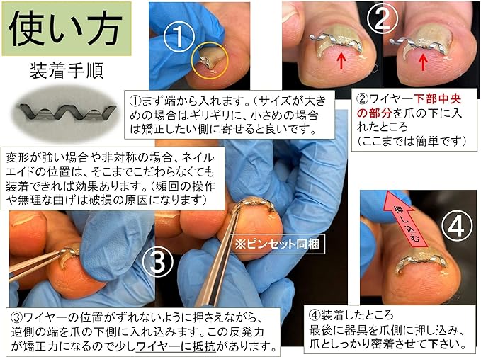 Nail Aid 0.6 inch (16 mm) Winding Nail Correction Self-Winding Wire Clip - NewNest Australia
