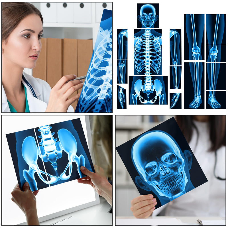 16 Pieces Human X Rays Bones X Rays Human Xrays for Kids Human Bones Body Display Play Table (Blue) Blue