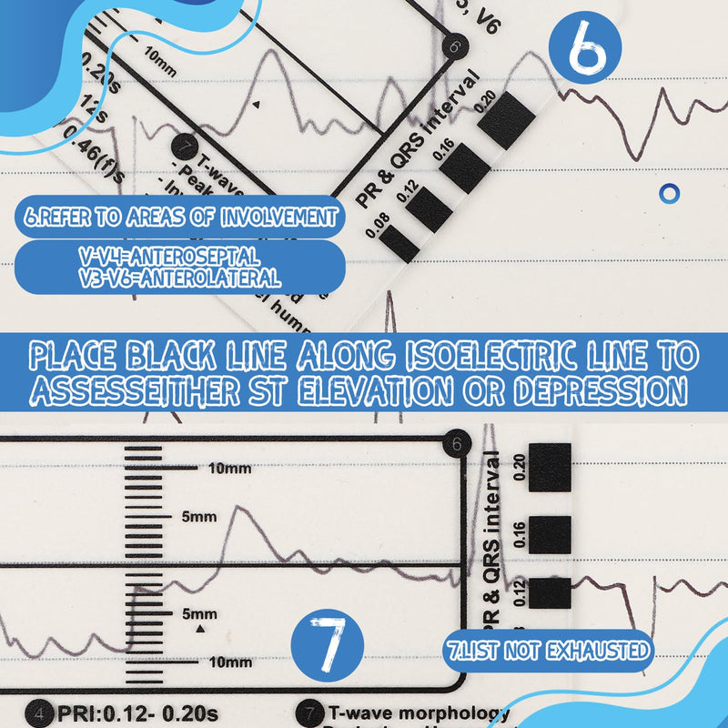 Sabary 20 Pcs ECG 7-Step Ruler, Clear Plastic EKG Calipers Measuring Tool, Portable Transparent Electrocardiogram Card for EKG Interpretation Nurse Doctor Medical Ruler