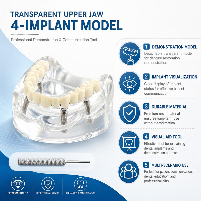 Dental Overdenture Inferior Model 4 Implants Upper Jaw Removable Demo Model | For Dentist Education and Study