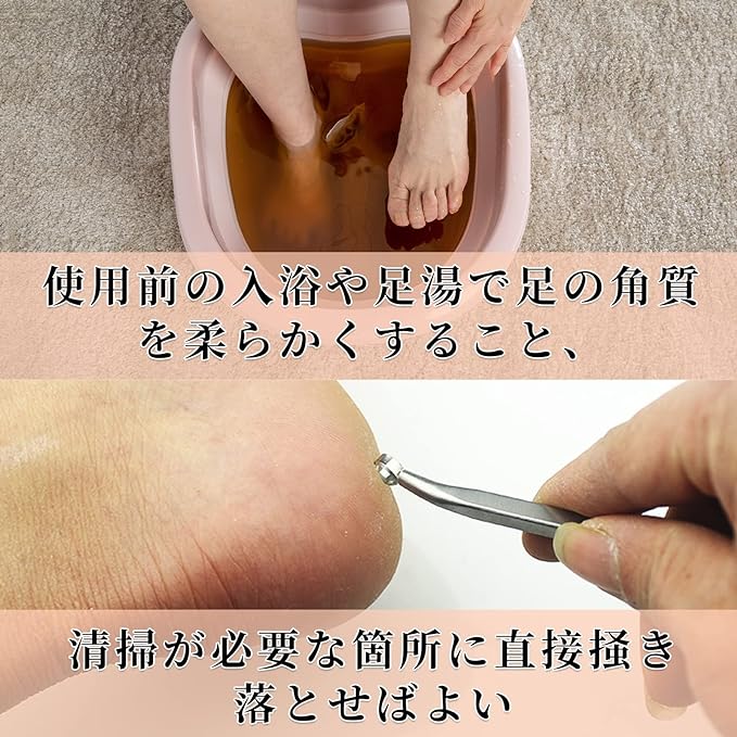 Doyime Exfoliating Remover, Exfoliating Fish, Exfoliating Files, Double-sided Foot Files, Foot Files, For Foot Files, For Dry And Dry Feet, Silver - NewNest Australia
