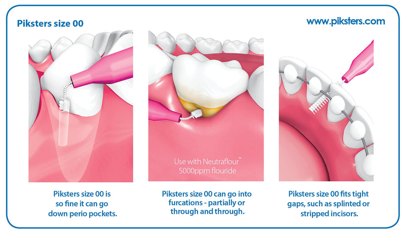 Piksters Interdental Brushes (40 Pack, Size 00 (Pink)) 40 Count (Pack of 1) Size 00 (Pink)