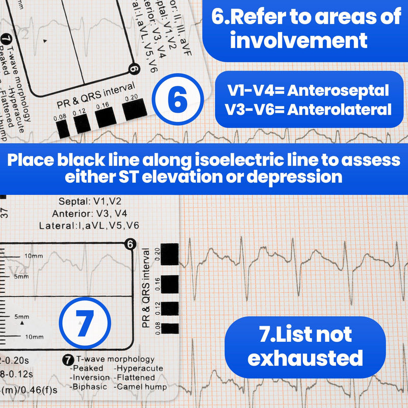 3pcs ECG 7 Step Ruler, Transparent EKG Calipers Ruler, Electrocardiogram Card Portable Plastic Measuring Tool for EKG Interpretation